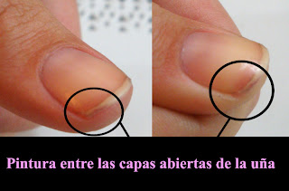 Las máscaras de las manchas de pigmento sobre la persona con el almidón